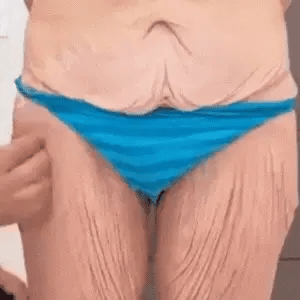 ספריי קולגן למיצוק וטיפוח העור